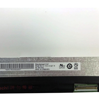 AUO bande verticale 15,6 pouces LCD volet B156HAN07.0 1920*1080 141PPI